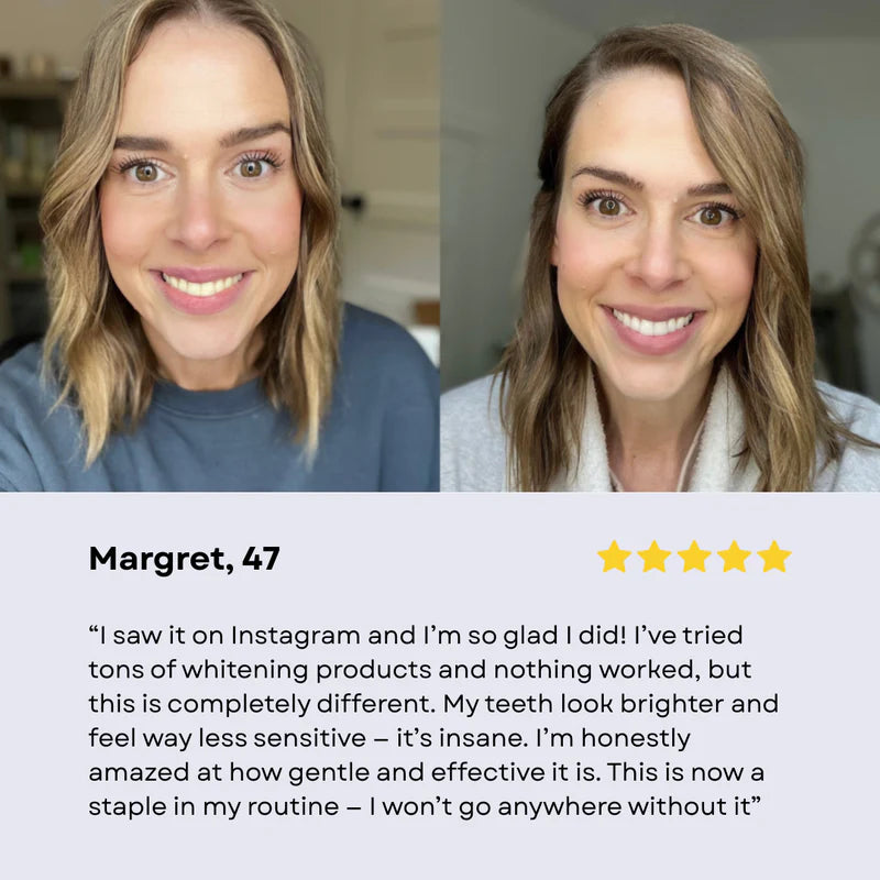 Niacinamide Toothpaste