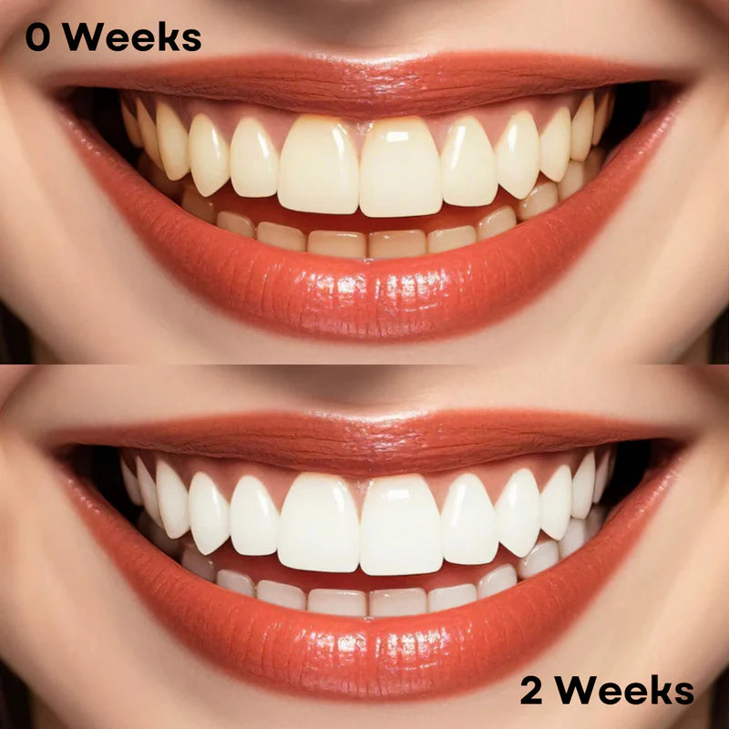 Niacinamide Toothpaste